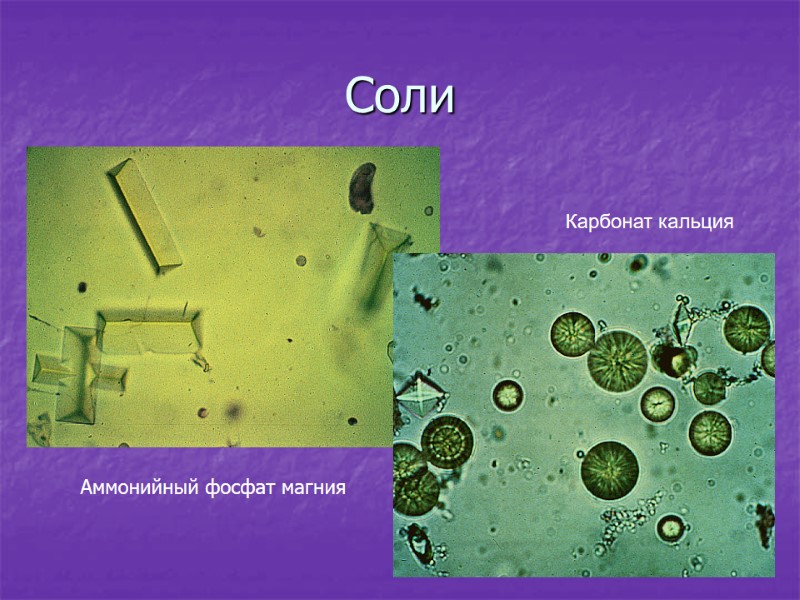 Карбонат кальция Аммонийный фосфат магния Соли